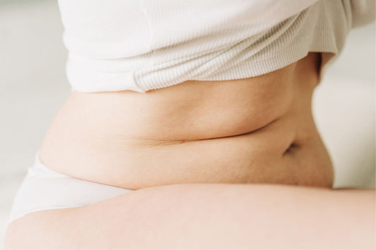 5 Signs You Have Cortisol Belly (And What to Do About It)